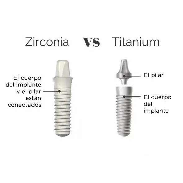 Implantes de Titanio vs Implantes de Zirconio